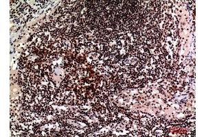 Immunohistochemistry (IHC) analysis of paraffin-embedded Human Lymph, antibody was diluted at 1:100. (2B4 antibody  (Internal Region))