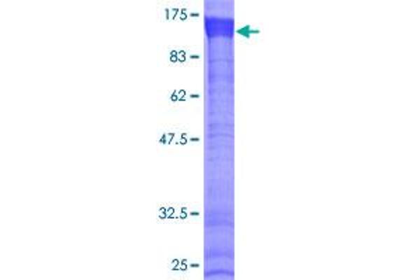 MEX3B Protein (AA 1-569) (GST tag)