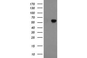 Western Blotting (WB) image for anti-Formiminotransferase Cyclodeaminase (FTCD) antibody (ABIN1496378) (FTCD antibody)