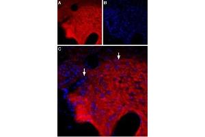 Expression of of GABA(A) θ receptor in rat hypothalamus - Immunohistochemical staining of rat hypothalamus using Anti-GABA(A) θ Receptor (GABRQ) (extracellular) Antibody (ABIN7043197, ABIN7044315 and ABIN7044316). (GABRQ antibody  (Extracellular, N-Term))