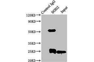 Immunoprecipitating SOD2 in K562 whole cell lysate Lane 1: Rabbit control IgG instead of ABIN7170983 in K562 whole cell lysate. (SOD2 antibody  (AA 64-175))