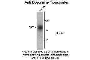 Western blot of Dopamine Transporter C-Terminus Human Antibody Western Blot of Rabbit Anti-Dopamine Transporter C-Terminus Human Antibody. (SLC6A3 antibody  (C-Term))
