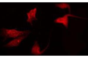 ABIN6272322 staining K562 by IF/ICC. (HOXD10 antibody  (Internal Region))