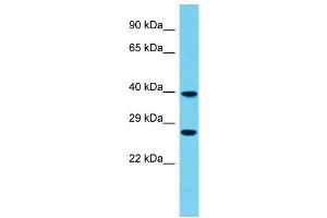 Host: Rabbit Target Name: FBXO44 Sample Type: Fetal Heart lysates Antibody Dilution: 1. (FBXO44 antibody  (Middle Region))