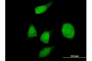 Immunofluorescence of purified MaxPab antibody to PHF17 on HeLa cell. (PHF17 antibody  (AA 1-509))