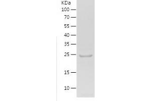 Western Blotting (WB) image for YTH Domain Family, Member 1 (YTHDF1) (AA 133-349) protein (His tag) (ABIN7125760) (YTHDF1 Protein (AA 133-349) (His tag))
