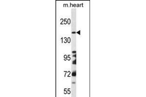 DCC Antibody (Center) (ABIN656268 and ABIN2845581) western blot analysis in mouse heart tissue lysates (35 μg/lane). (DCC antibody  (AA 643-670))