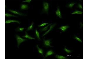Immunofluorescence of monoclonal antibody to CRY2 on HeLa cell. (CRY2 antibody  (AA 141-231))