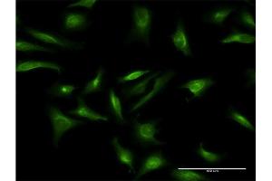 Immunofluorescence of monoclonal antibody to CRY2 on HeLa cell.