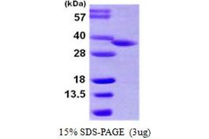 SDS-PAGE (SDS) image for Hydroxysteroid (17-Beta) Dehydrogenase 8 (HSD17B8) (AA 1-261) protein (His tag) (ABIN667899)