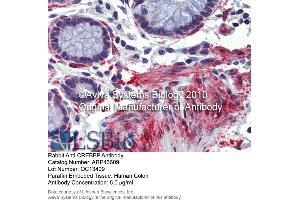 Immunohistochemistry (IHC) image for anti-CREB Binding Protein (CREBBP) (N-Term) antibody (ABIN2781491) (CBP antibody  (N-Term))