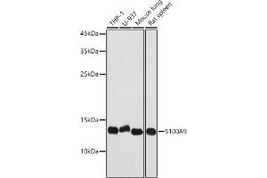 Western blot analysis of extracts of various cell lines, using S100 antibody (842) at 1:1000 dilution. (S100A9 antibody  (AA 1-114))