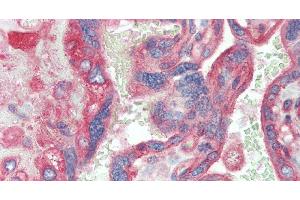 Immunohistochemistry of paraffin-embedded Placenta tissue using CD151 Polyclonal Antibody at dilution of 1:120. (CD151 antibody)