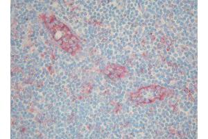 Image no. 1 for anti-serpin Peptidase Inhibitor, Clade A (Alpha-1 Antiproteinase, Antitrypsin), Member 3 (SERPINA3) antibody (ABIN379996) (SERPINA3 antibody)