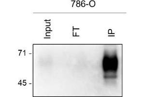 786-O cell lysate was prepared by 1 mL of RIPA buffer from 1.