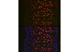 Immunofluorescence analysis of rat trachea using MMP13 Rabbit pAb (ABIN7268418) at dilution of 1:100 (40x lens). (MMP13 antibody  (AA 262-471))
