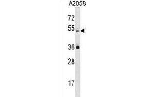 PREL Antibody (Center) (ABIN1537984 and ABIN2850411) western blot analysis in  cell line lysates (35 μg/lane). (PRAMEL antibody  (AA 184-211))