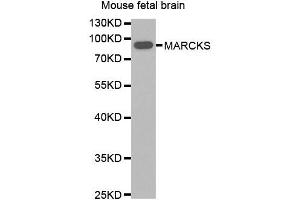 Western blot analysis of extracts of Mouse fetal brain, using MARCKS antibody.