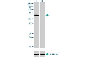 Western blot analysis of GGA1 over-expressed 293 cell line, cotransfected with GGA1 Validated Chimera RNAi (Lane 2) or non-transfected control (Lane 1).