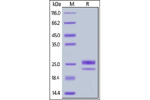 Human GITR Ligand, His Tag on  under reducing (R) condition. (TNFSF18 Protein (AA 50-177) (His tag))