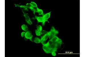 Immunofluorescence of purified MaxPab antibody to GPR34 on 293 cell. (GPR34 antibody  (AA 1-381))