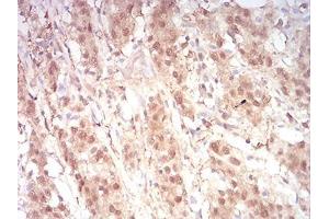 Immunohistochemistry (IHC) image for anti-RAN, Member RAS Oncogene Family (RAN) (AA 1-216) antibody (ABIN5876159) (RAN antibody  (AA 1-216))