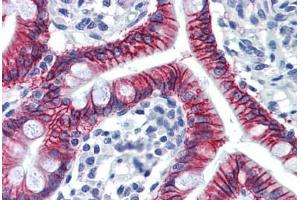 Human Small Intestine: Formalin-Fixed, Paraffin-Embedded (FFPE) (LI Cadherin antibody  (AA 24-132))