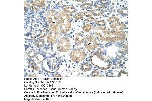 Rabbit Anti-RAVER1Antibody  Paraffin Embedded Tissue: Human Kidney Cellular Data: Epithelial cells of renal tubule Antibody Concentration: 4. (RAVER1 antibody  (N-Term))