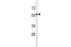 IL17RE antibody western blot analysis in HepG2 lysate. (IL17RE antibody  (AA 87-116))