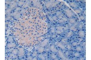 IHC-P analysis of Rat Pancreas Tissue, with DAB staining. (Laminin alpha 1 antibody  (AA 1156-1276))