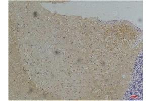 Immunohistochemistry (IHC) analysis of paraffin-embedded Mouse Brain Tissue using KV1. (Kv1.1 Potassium Channel antibody)