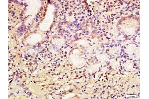 Formalin-fixed and paraffin embedded human gastric mucosa labeled with Anti-CA IX/CA9 Polyclonal Antibody, Unconjugated  at 1:200 followed by conjugation to the secondary antibody and DAB staining. (CA9 antibody  (AA 251-350))