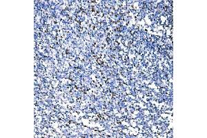 IHC analysis of RAD18 using anti-RAD18 antibody (ABIN7599364). (RAD18 antibody  (AA 1-408))