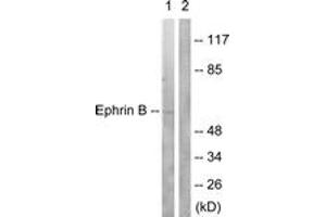 Western blot analysis of extracts from 293 cells, treated with EGF 200ng/ml 5', using EFNB1/2 (Ab-330) Antibody. (EFNB1/2 (AA 284-333) antibody)