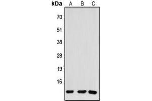 Western blot analysis of CCL26 expression in HEK293T (A), NS-1 (B), H9C2 (C) whole cell lysates. (CCL26 antibody  (Center))