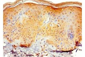 Immunohistochemistry of paraffin-embedded human skin tissue using ABIN7151129 at dilution of 1:100 (RNF125 antibody  (AA 1-232))