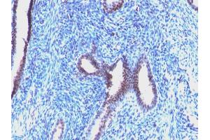 Cyclin B1 antibody