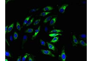 Immunofluorescent analysis of Hela cells using ABIN7175917 at dilution of 1:100 and Alexa Fluor 488-congugated AffiniPure Goat Anti-Rabbit IgG(H+L) (xpr1 antibody  (AA 529-696))