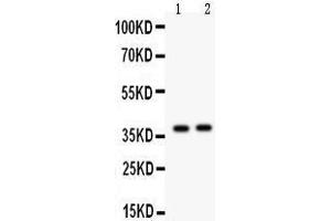 Anti- Calretinin Picoband antibody, Western blotting All lanes: Anti Calretinin  at 0. (Calretinin antibody  (C-Term))
