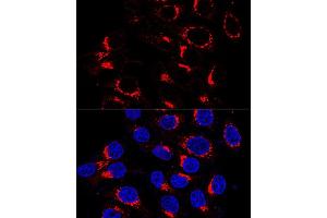 Immunofluorescence analysis of HeLa cells using USO1 antibody (ABIN7271235) at dilution of 1:200 (60x lens). (USO1 antibody  (AA 663-962))