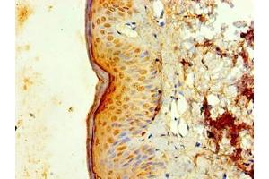 Immunohistochemistry of paraffin-embedded human skin tissue using ABIN7156730 at dilution of 1:100 (IL1A antibody  (AA 1-152))