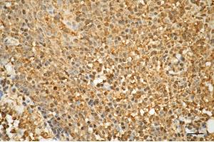 Immunohistochemistry was performed on paraffin-embedded human tonsillitis using CD86 antibody (ABIN7797986), 1:100). (Recombinant CD86 antibody)