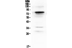 Western blot analysis of Complement C9 using anti-Complement C9 antibody . (C9 antibody  (AA 289-515))