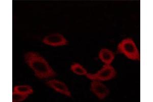ABIN6267258 staining BT-20 cells by ICC/IF. (EGFR antibody  (pThr678))