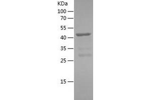 Western Blotting (WB) image for Calmodulin Regulated Spectrin-associated Protein 1-like 1 (CAMSAP1L1) (AA 368-574) protein (His-IF2DI Tag) (ABIN7283805) (CAMSAP2 Protein (AA 368-574) (His-IF2DI Tag))