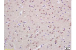 Formalin-fixed and paraffin embedded rat brain labeled with Anti-Prox1 Polyclonal Antibody, Unconjugated (ABIN680503) at 1:200 followed by conjugation to the secondary antibody and DAB staining (PROX1 antibody  (AA 151-250))