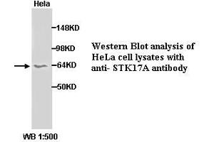 Image no. 1 for anti-serine/threonine Kinase 17a (STK17A) (C-Term) antibody (ABIN790926) (STK17A antibody  (C-Term))