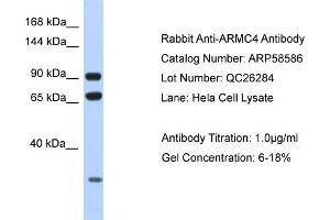 Western Blotting (WB) image for anti-Armadillo Repeat Containing 4 (ARMC4) (N-Term) antibody (ABIN2787749) (ARMC4 antibody  (N-Term))