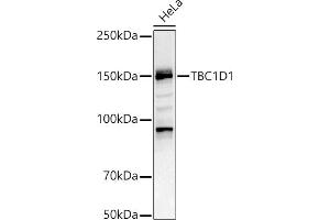 Western blot analysis of extracts of HeLa cells, using TBC1D1 antibody (ABIN6129487, ABIN6148878, ABIN6148879 and ABIN6225024) at 1:1000 dilution. (TBC1D1 antibody  (AA 520-710))