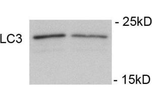 Western Blotting (WB) image for anti-Microtubule-Associated Protein 1 Light Chain 3 alpha (MAP1LC3A) (AA 1-30), (N-Term), (pSer12) antibody (ABIN1449623)